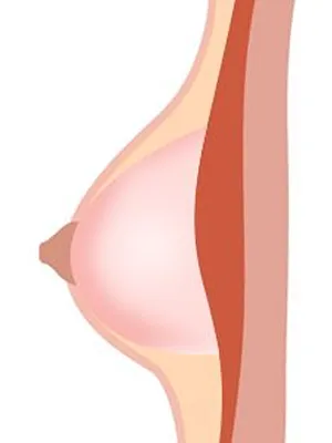 Jelly （Ultra Soft）